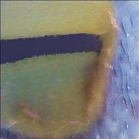 Picnic Point-North Lynnwood Washington Backpage Gfe